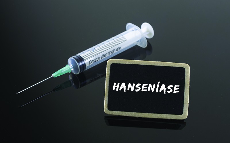 Hanseníase: o que é, quais os sintomas e tratamentos - Exmed blog